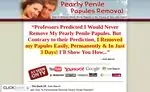 Pearly Penile Papules Removal